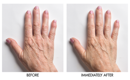 Instant Hand Perfector