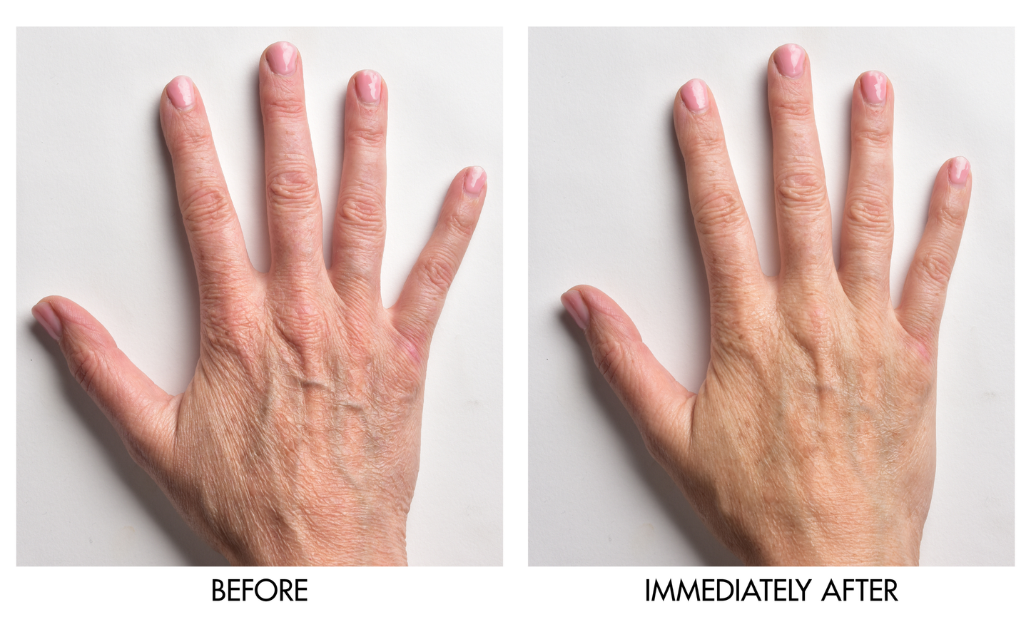 Instant Hand Perfector